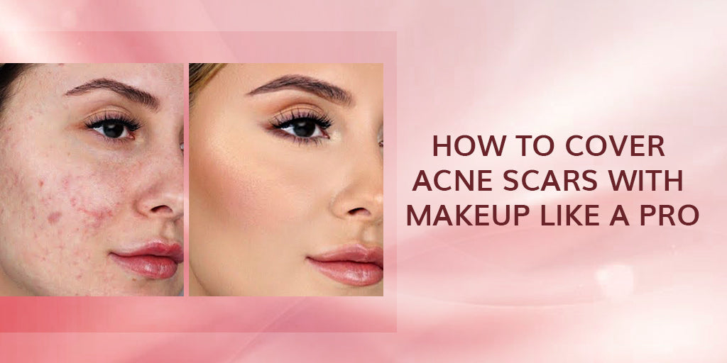 How to Cover Acne Scars with Makeup Like a Pro