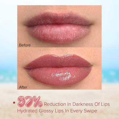 Hydra Lips